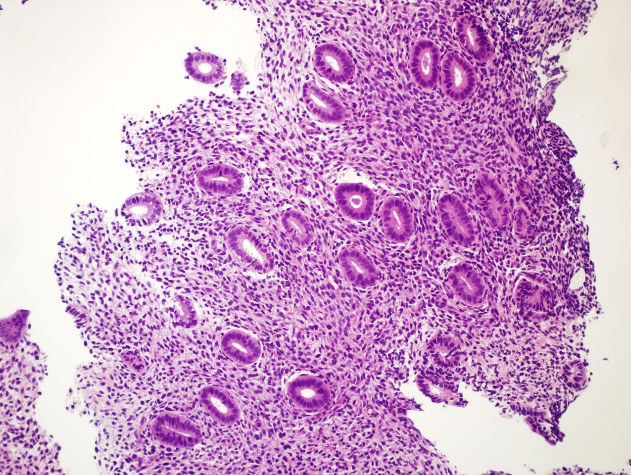 Test di recettività endometriale (ERA)